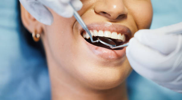 Best Emergency Dentist for Lost Fillings or Crowns in Woodbury Center, CT