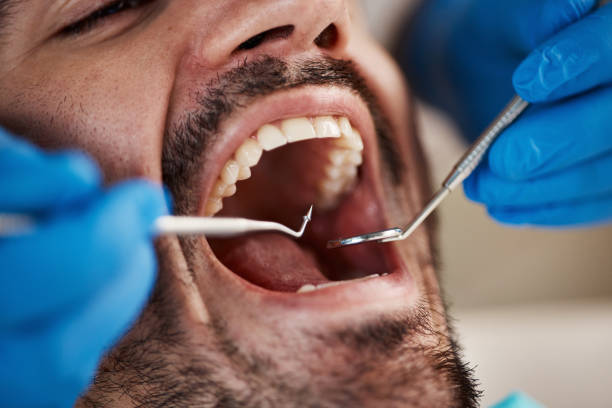 Best Emergency Dentist for Knocked-Out Tooth in Woodbury Center, CT