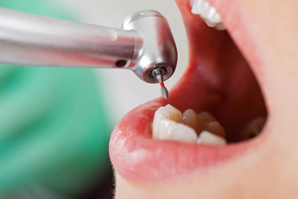 Best Emergency Cosmetic Dentistry in Woodbury Center, CT